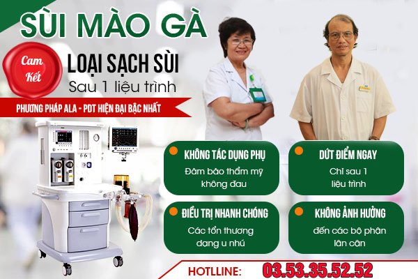 điều trị sùi mào gà