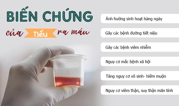 tiểu ra máu có nguy hiểm không