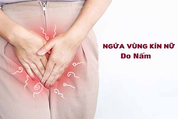 Nấm vùng kín nữ