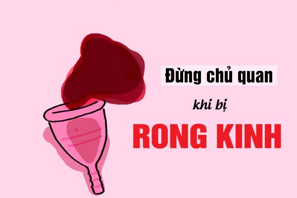 rong kinh đừng coi thường