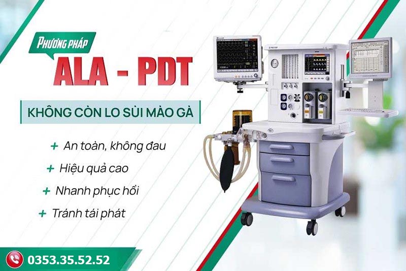 phương pháp ala-pdt